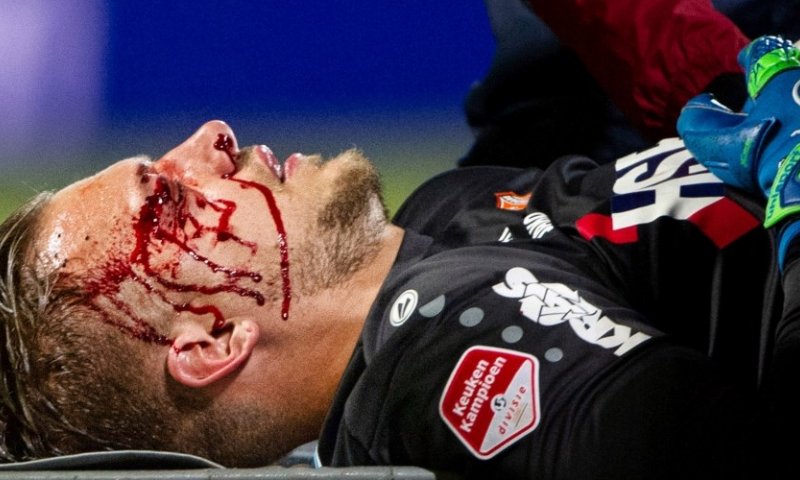Zware hoofdblessure voor FC Volendam-doelman: 'Met succes geopereerd' Afbeelding: Zware hoofdblessure voor FC Volendam-doelman: 'Met succes geopereerd'