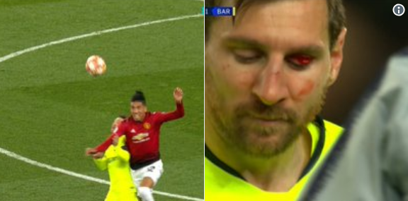 Pijnlijke beelden: Messi blijft achter met bebloed ooglid na beuk van Smalling